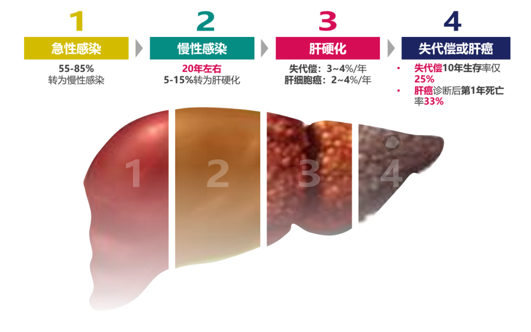 悄悄變成肝硬化、肝癌，很多人感染了卻不知道