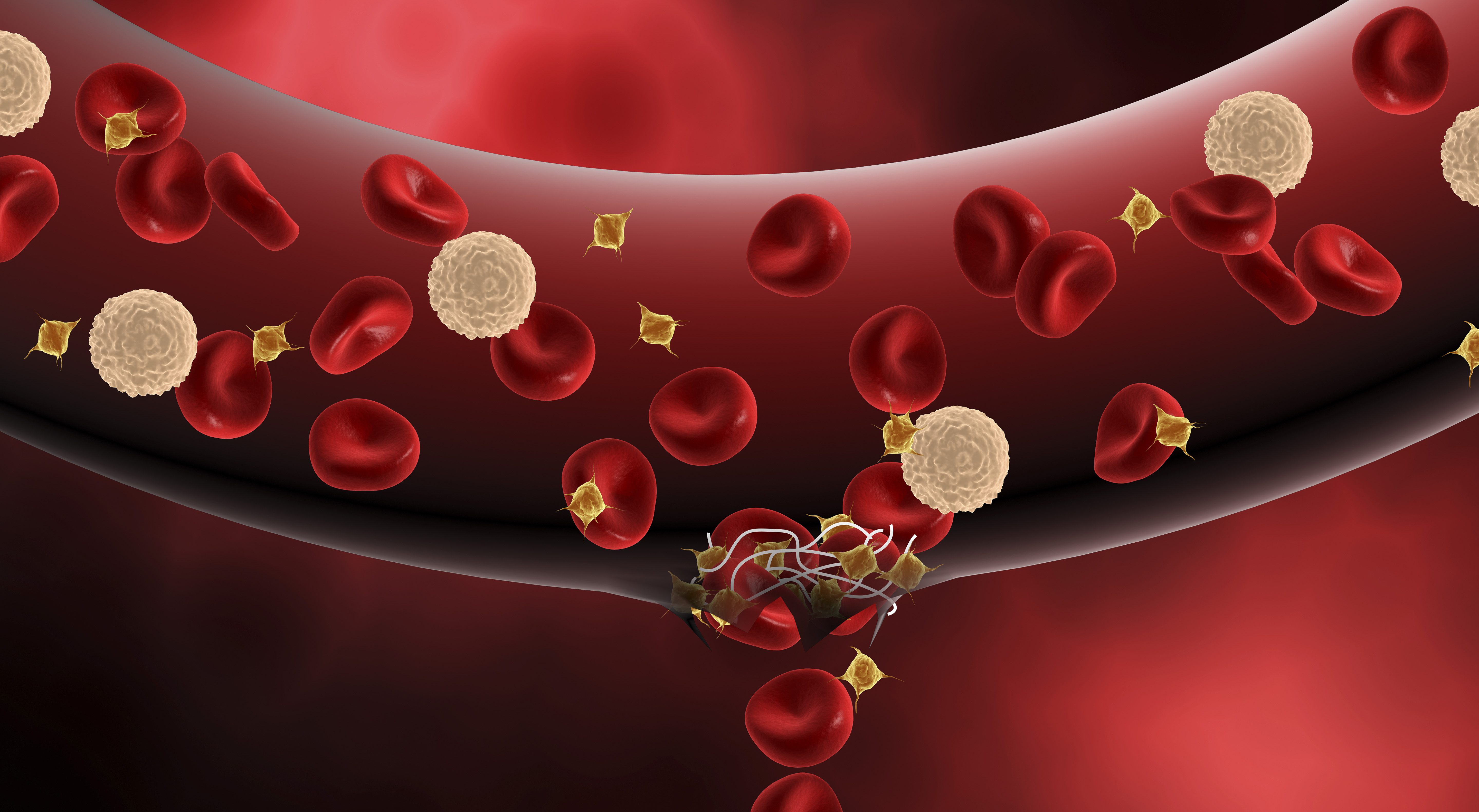 STK701195H.jpg STK701195H.jpg